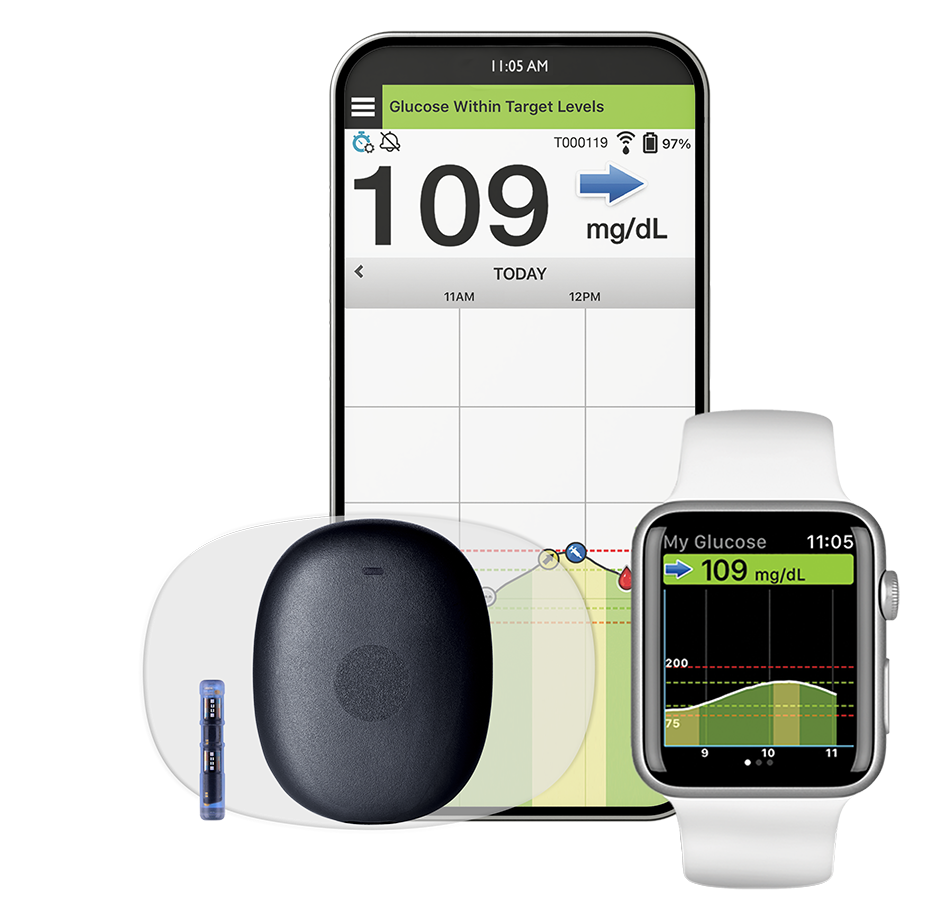 Eversense CGM system for diabetes management in Royal Oak, Michigan